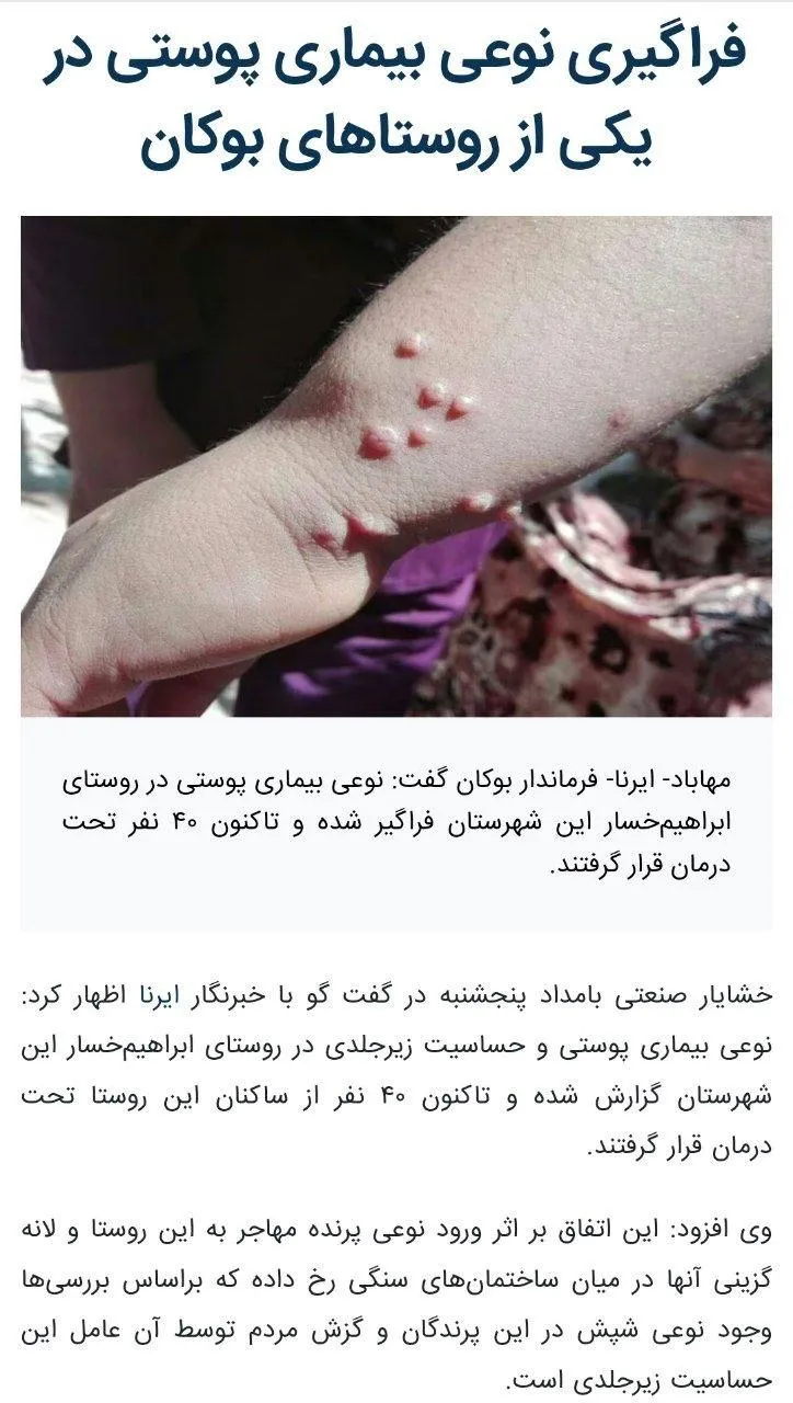 فرماندار بوکان سه روز قبل در خبرگزاری ایرنا از فراگیری! نوعی بیماری پوستی در یکی از روستاهای بوکان خبر داده است.