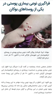 فرماندار بوکان سه روز قبل در خبرگزاری ایرنا از فراگیری! نوعی بیماری پوستی در یکی از روستاهای بوکان خبر داده است.